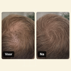 Haarlijn Booster