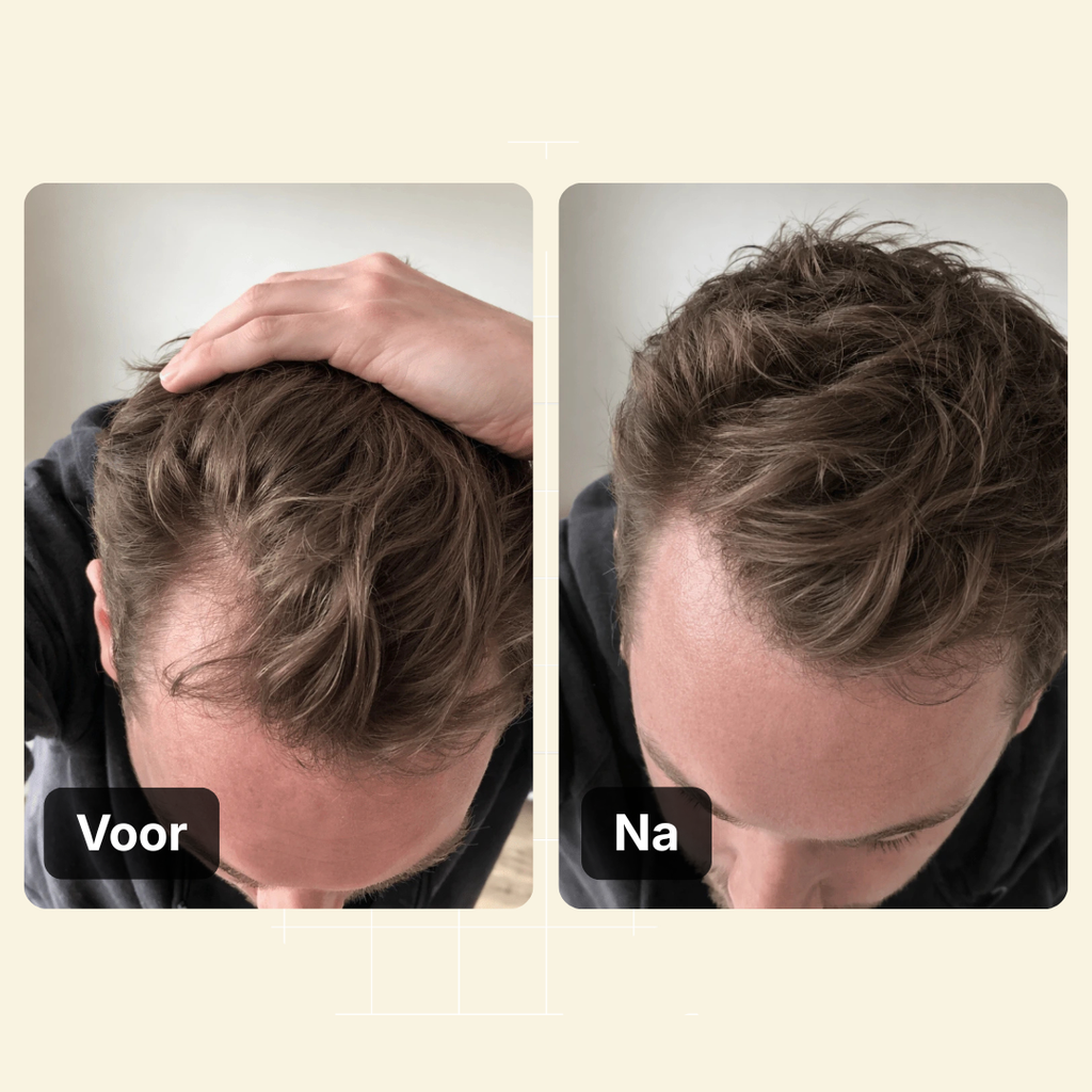 Haarlijn Booster