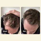 Haarlijn Booster