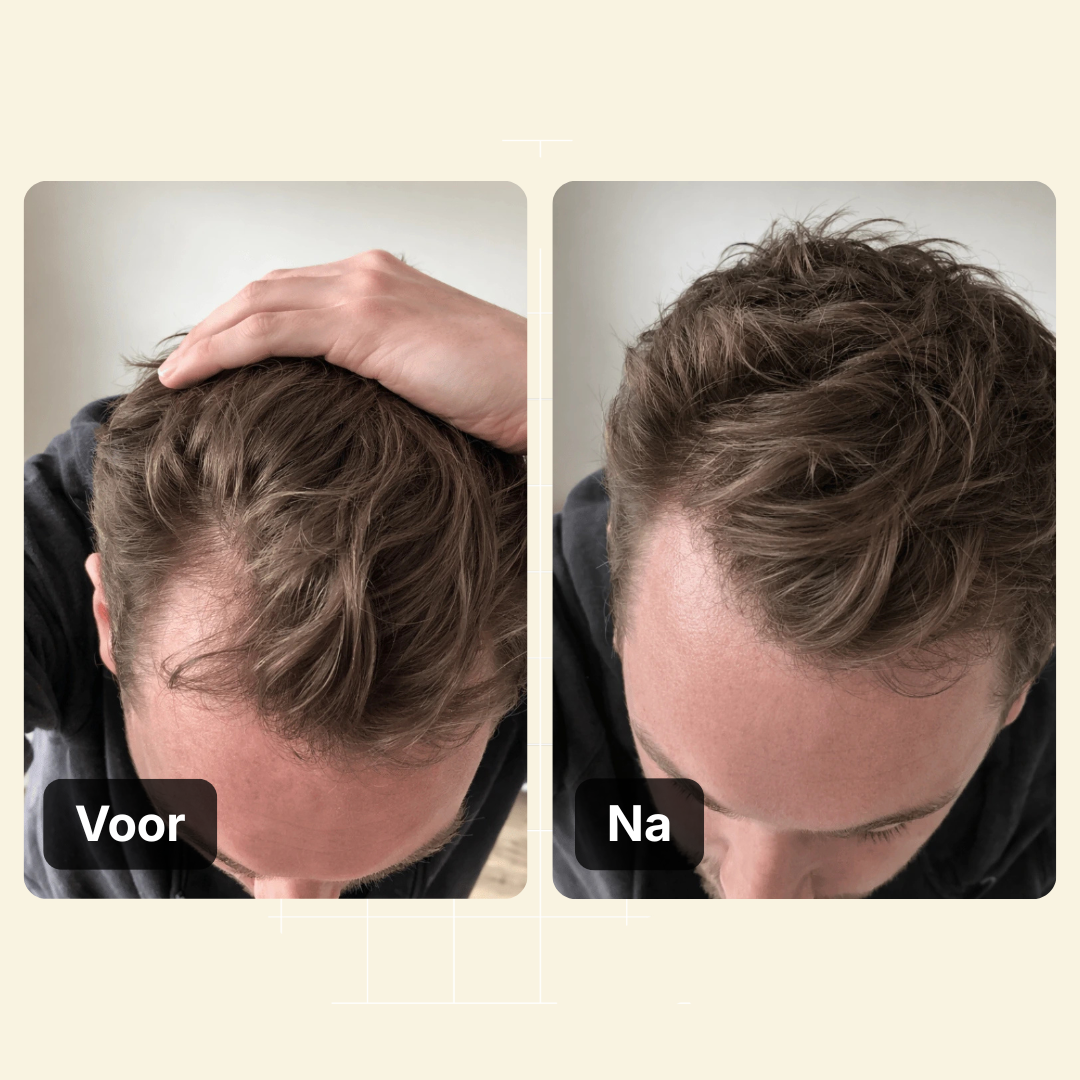 Haarlijn Booster